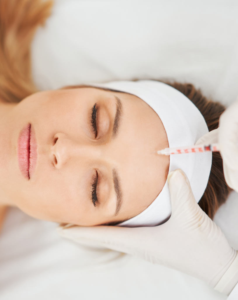 Botox for Migraine Relief