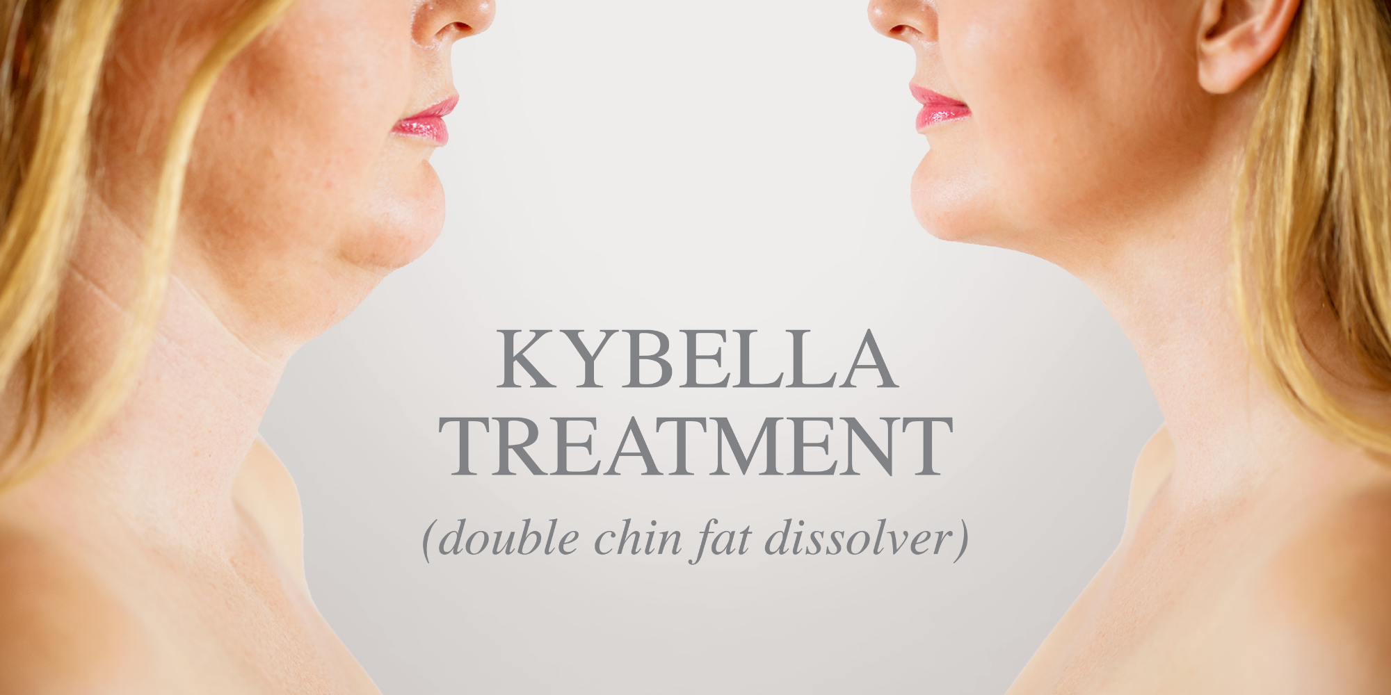 KYBELLA